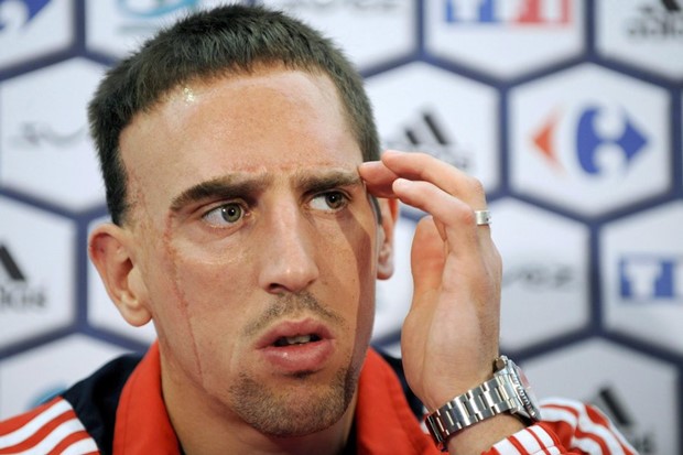 Ribery želi da Domenech ostane