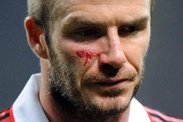 "Pobjede ćemo posvetiti Beckhamu"