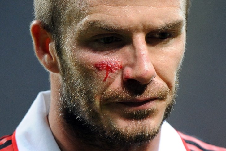 "Pobjede ćemo posvetiti Beckhamu"