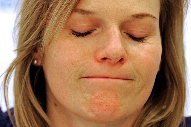 Schild uspješno operirana: "Ne sumnjam da ću se vratiti u stopostotnu formu"