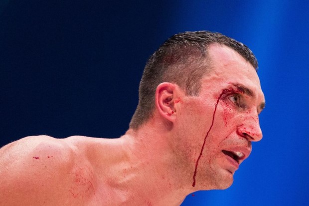 Prekinut sparing Klička i Hrgovića