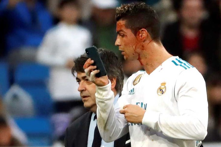 VIDEO: Krasan gol Luke Modrića u visokoj pobjedi Reala, Ronaldo nakon drugog gola završio krvave glave