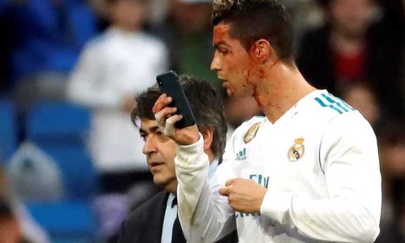 VIDEO: Krasan gol Luke Modrića u visokoj pobjedi Reala, Ronaldo nakon drugog gola završio krvave glave