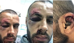 Slaven Belupo objavio fotografije Ejupijeve "lakše" ozljede: "Muzo, vrati nam se što prije"