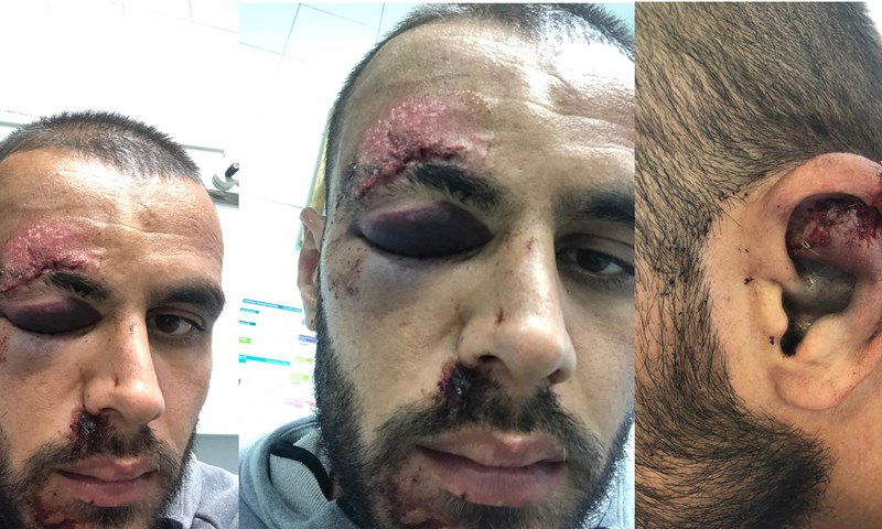 Slaven Belupo objavio fotografije Ejupijeve "lakše" ozljede: "Muzo, vrati nam se što prije"