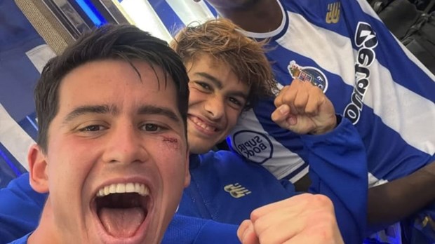 Dominik Prpić pohvalio se s četiri šava ispod oka poslije duela s Markom Arnautovićem