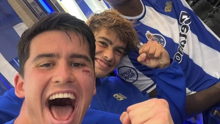 Dominik Prpić pohvalio se s četiri šava ispod oka poslije duela s Markom Arnautovićem